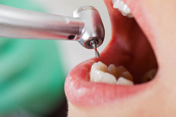 Best Emergency Denture Repair in Golden Beach, MD